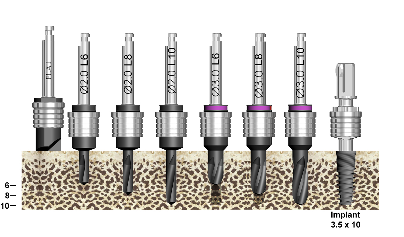 BIO Max Keyless Fully Guided Kit Sequence Blue Sky Bio